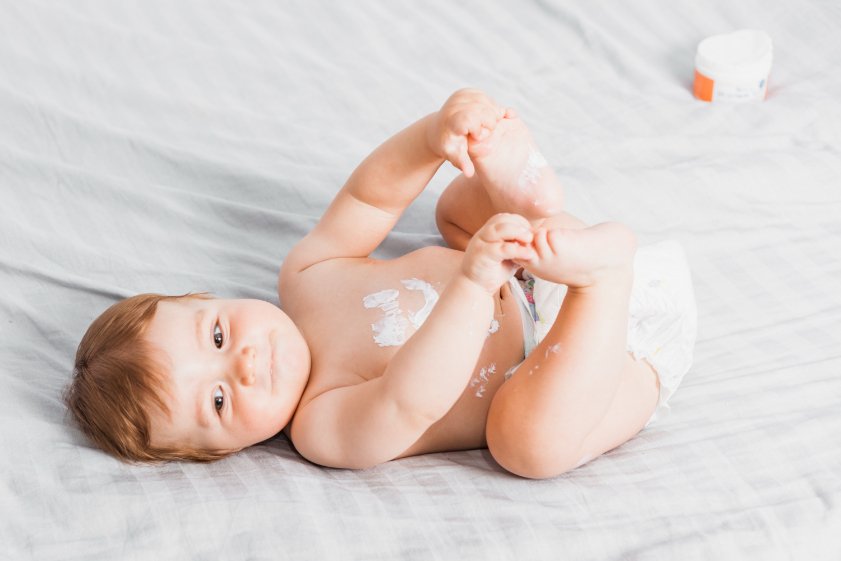 5 Cara Mengatasi Kulit Bayi Kering dan Kasar 5 Cara Mengatasi Kulit Bayi Kering dan Kasar