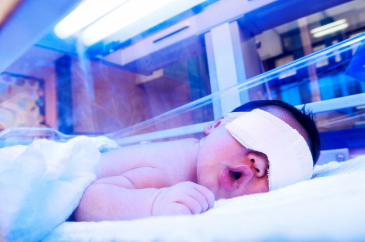 5 Cara Mengembalikan Warna Kulit Bayi Setelah Fototerapi
